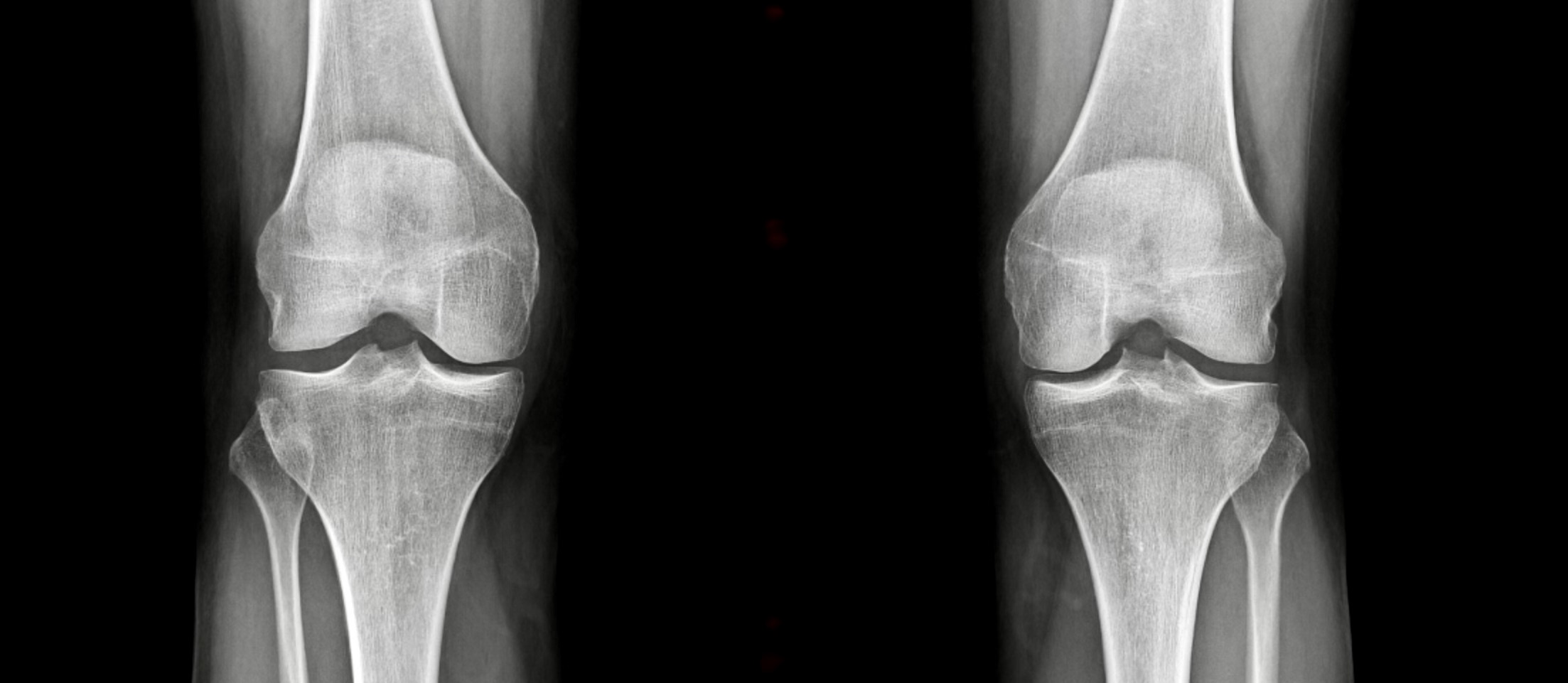 chirurgie orthopedique perigueux